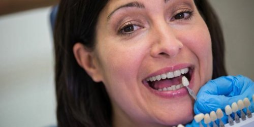 Esthetique dentaire : les differentes options disponibles en France