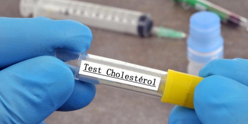 Suspicion de cholesterol : les examens a realiser