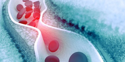 Cholesterol : les differents medicaments qui le reduisent