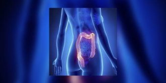 Depiste tot, le taux de guerison du cancer colorectal atteint 90%