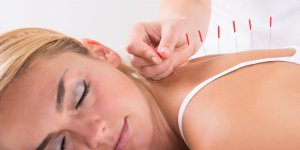 Medecine traditionnelle chinoise : les atouts sante et prevention de l’acupuncture 