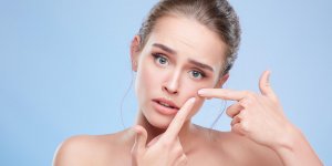 Vaincre l-acne en douceur en 10 lecons 