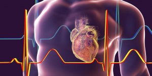 Insuffisance cardiaque droite : comment la reconnaitre