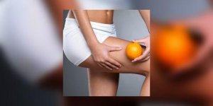 Comment enlever la cellulite : toutes les solutions anti-cellulite