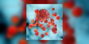 Cancer : l’immunotherapie personnalisee, en chemin pour y arriver !