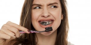 Dentifrice au charbon, un danger pour les dents ?