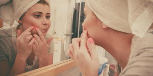 Acne : bientot un vaccin contre ce probleme de peau ?