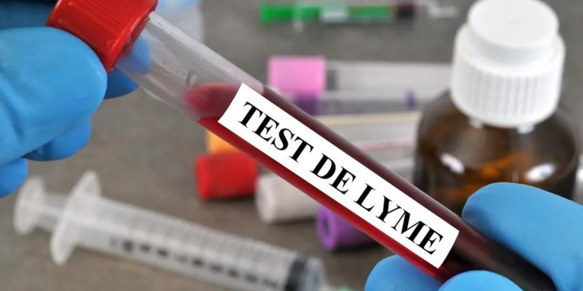 test de lyme test de lyme